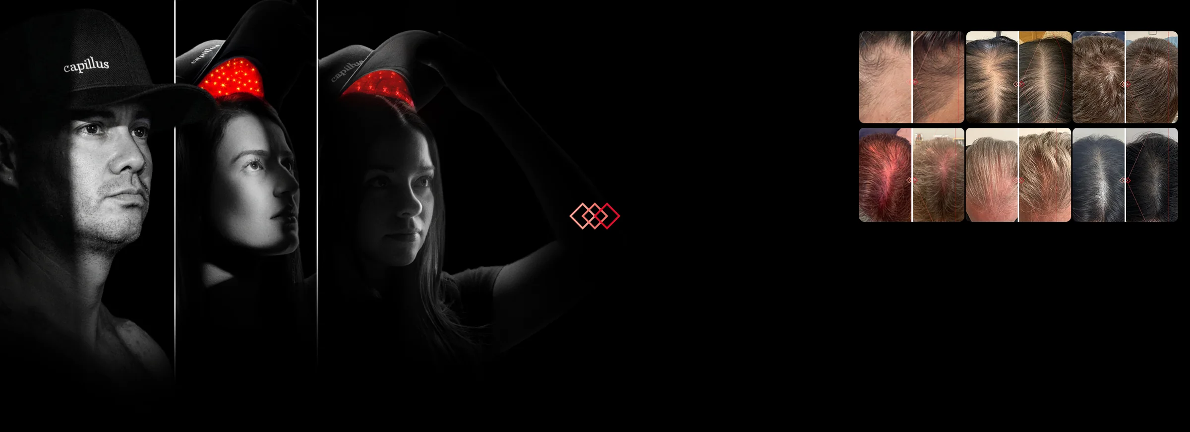 Clinically Proven Light Therapy Solutions